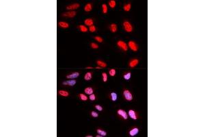 Image no. 14 for anti-PRP3 Pre-mRNA Processing Factor 3 Homolog (PRPF3) antibody (ABIN6146260)
