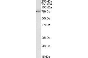 Image no. 2 for anti-Matrix Metallopeptidase 9 (Gelatinase B, 92kDa Gelatinase, 92kDa Type IV Collagenase) (MMP9) (Internal Region) antibody (ABIN5539846)
