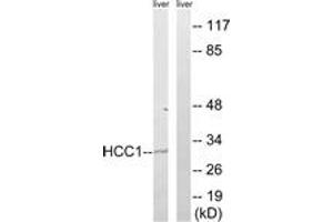 Image no. 1 for anti-RNA Binding Motif Protein 39 (RBM39) (AA 147-196) antibody (ABIN1535119)