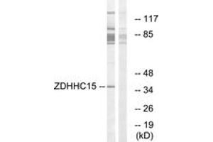 Image no. 1 for anti-Zinc Finger, DHHC-Type Containing 15 (ZDHHC15) (AA 288-337) antibody (ABIN1535141)