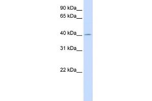Image no. 1 for anti-Acetyl-CoA Acyltransferase 2 (ACAA2) (N-Term) antibody (ABIN2783320)