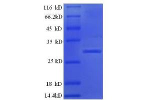 Image no. 1 for Kallikrein B, Plasma (Fletcher Factor) 1 (KLKB1) (AA 391-638), (Light Chain) protein (His tag) (ABIN5713586)