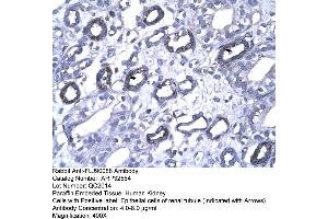 Image no. 1 for anti-Forkhead Box P1 (FOXP1) (N-Term) antibody (ABIN2779725)