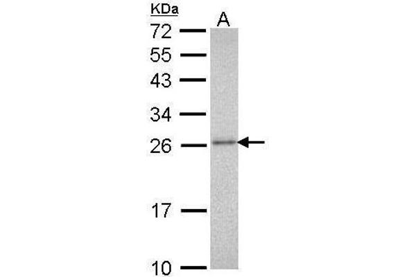 anti-Proteasome Subunit Alpha Type 3 (PSMA3) (Center) antibody