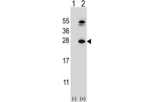 Image no. 2 for anti-Dihydrofolate Reductase (DHFR) (AA 135-164) antibody (ABIN3030729)