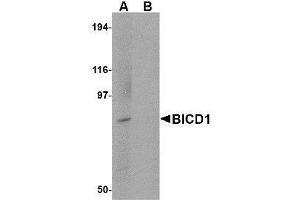 Western blot analysis of BICD1 in Daudi cell lysate with AP30144PU-N BICD1 antibody at 1 μg/ml in (A) the absence and (B) the presence of blocking peptide.