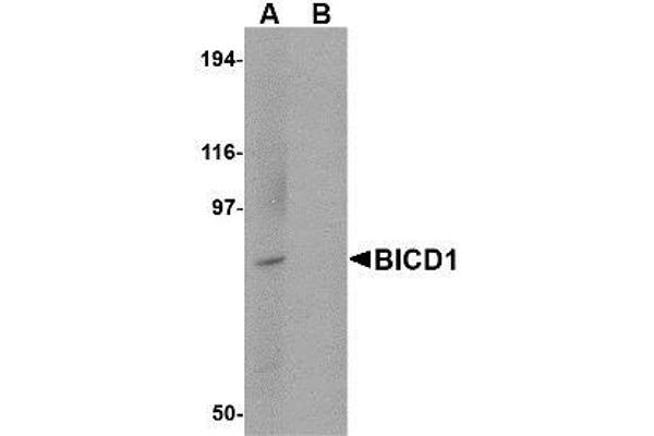 anti-Bicaudal D Homolog 1 (BICD1) (C-Term) antibody