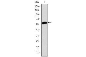 Image no. 5 for anti-Junction Plakoglobin (JUP) antibody (ABIN1107899)