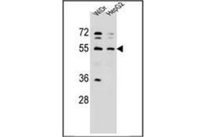 Image no. 4 for anti-Asparaginyl-tRNA Synthetase (NARS) (AA 31-60), (N-Term) antibody (ABIN953606)