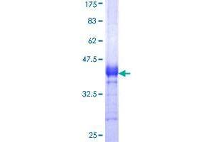 SLC29A4 Protein (AA 283-345) (GST tag)