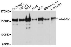 CC2D1A antibody  (AA 1-150)