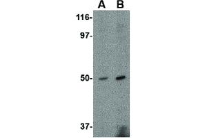 Image no. 1 for anti-Fasciculation and Elongation Protein zeta 2 (Zygin II) (FEZ2) (C-Term) antibody (ABIN6657048)