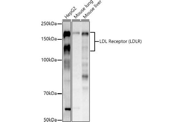 LDLR antibody  (C-Term)