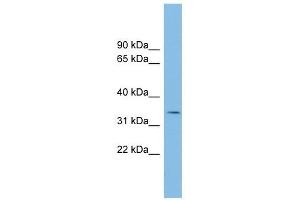 anti-Polycomb Group Ring Finger 6 (PCGF6) (Middle Region) antibody