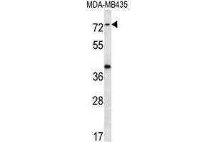 Image no. 1 for anti-Synaptotagmin Like Protein 1 (SYTL1) (AA 291-321), (Middle Region) antibody (ABIN955048)
