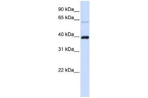 Image no. 1 for anti-PHD Finger Protein 6 (PHF6) (C-Term) antibody (ABIN928531)