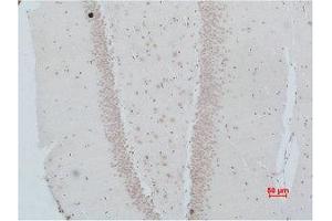 Image no. 2 for anti-Neuromedin B Receptor (NMBR) antibody (ABIN3181543)