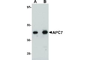 Image no. 1 for anti-Anaphase Promoting Complex Subunit 7 (ANAPC7) (C-Term) antibody (ABIN6656616)