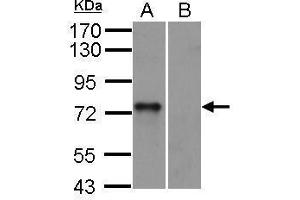 Image no. 7 for anti-Spleen tyrosine Kinase (SYK) (Internal Region) antibody (ABIN2854855)