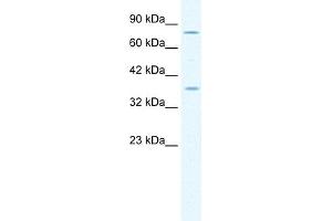 Image no. 1 for anti-Minichromosome Maintenance Deficient 4 (MCM4) (Middle Region) antibody (ABIN2774884)