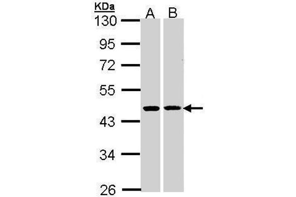 HSD3B2 Antikörper