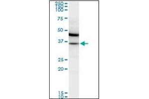 Image no. 2 for anti-Malate Dehydrogenase 2, NAD (Mitochondrial) (MDH2) antibody (ABIN953359)