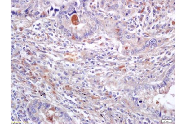 ERK1/2 antibody  (AA 301-358)