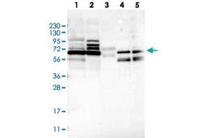 MUM1L1 antibody