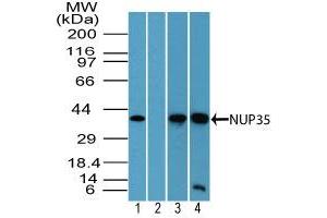 Image no. 2 for anti-Nucleoporin 35kDa (NUP35) (AA 280-330) antibody (ABIN960296)