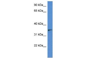 Image no. 2 for anti-Sorbitol Dehydrogenase (SORD) (N-Term) antibody (ABIN2788686)