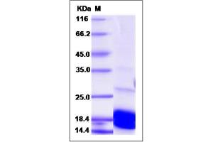 Image no. 1 for BCL2-Like 11 (Apoptosis Facilitator) (BCL2L11) (AA 2-120) protein (His tag) (ABIN2005926)