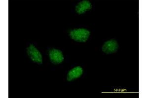 Immunofluorescence of purified MaxPab antibody to RIP on HeLa cell.