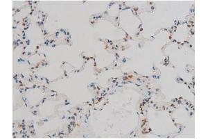 Image no. 2 for anti-Jun D Proto-Oncogene (JUND) (pSer255) antibody (ABIN6255135)