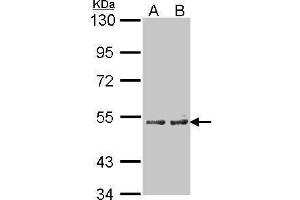 Image no. 1 for anti-Cytochrome P450, Family 4, Subfamily A, Polypeptide 11 (CYP4A11) (Center) antibody (ABIN2855647)