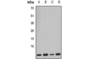 Image no. 2 for anti-Pterin-4 alpha-Carbinolamine Dehydratase/dimerization Cofactor of Hepatocyte Nuclear Factor 1 alpha (PCBD1) (full length) antibody (ABIN6005350)