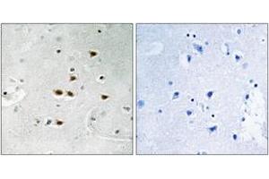 Image no. 1 for anti-Itchy E3 Ubiquitin Protein Ligase Homolog (ITCH) (AA 386-435), (pTyr420) antibody (ABIN1532110)