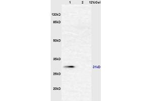 Image no. 1 for anti-alpha-2-HS-Glycoprotein (AHSG) (AA 200-240) antibody (ABIN681733)