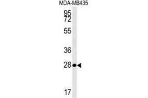Image no. 2 for anti-Mitochondrial rRNA Methyltransferase 1 Homolog (MRM1) (AA 87-117), (N-Term) antibody (ABIN953500)
