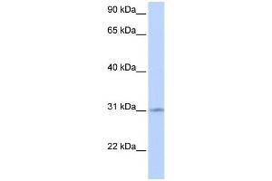 WB Suggested Anti-ZNF146 Antibody Titration:  0.
