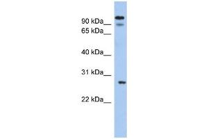 Image no. 1 for anti-Voltage-Dependent Anion Channel 3 (VDAC3) (N-Term) antibody (ABIN2776181)