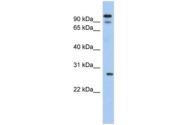 anti-Voltage-Dependent Anion Channel 3 (VDAC3) (N-Term) antibody