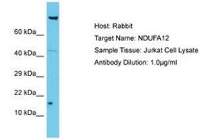 Image no. 1 for anti-NADH Dehydrogenase (Ubiquinone) 1 alpha Subcomplex, 12 (NDUFA12) (AA 6-55) antibody (ABIN6750643)