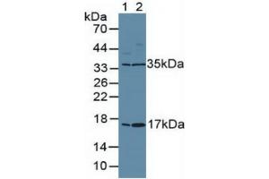 Image no. 2 for Antigen Identified By Monoclonal Antibody Ki-67 (MKI67) ELISA Kit (ABIN6720578)