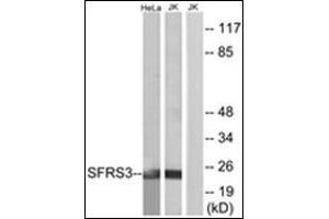 Image no. 3 for anti-serine/arginine-Rich Splicing Factor 3 (SRSF3) (C-Term) antibody (ABIN954767)