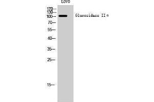 Image no. 1 for anti-Glucosidase, Alpha, Neutral AB (GANAB) (Internal Region) antibody (ABIN3184803)