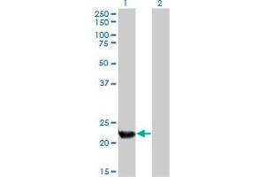 Image no. 1 for anti-Pallidin Homolog (PLDN) (AA 1-99) antibody (ABIN525663)