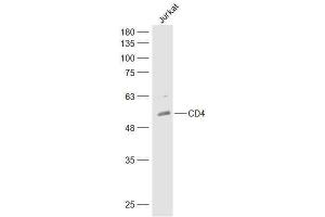 Image no. 4 for anti-CD4 (CD4) (AA 230-280) antibody (ABIN672936)