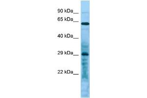 Image no. 1 for anti-Leucine Rich Repeat Containing 10 (LRRC10) (C-Term) antibody (ABIN2790557)