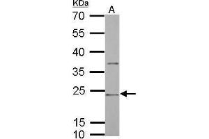 Image no. 2 for anti-HLA-DR-gamma (CD74) (N-Term) antibody (ABIN2856756)