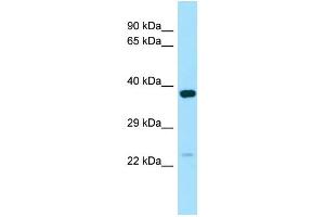 Image no. 1 for anti-Nucleoredoxin Like Protein 1 (NXNL1) (C-Term) antibody (ABIN2790126)